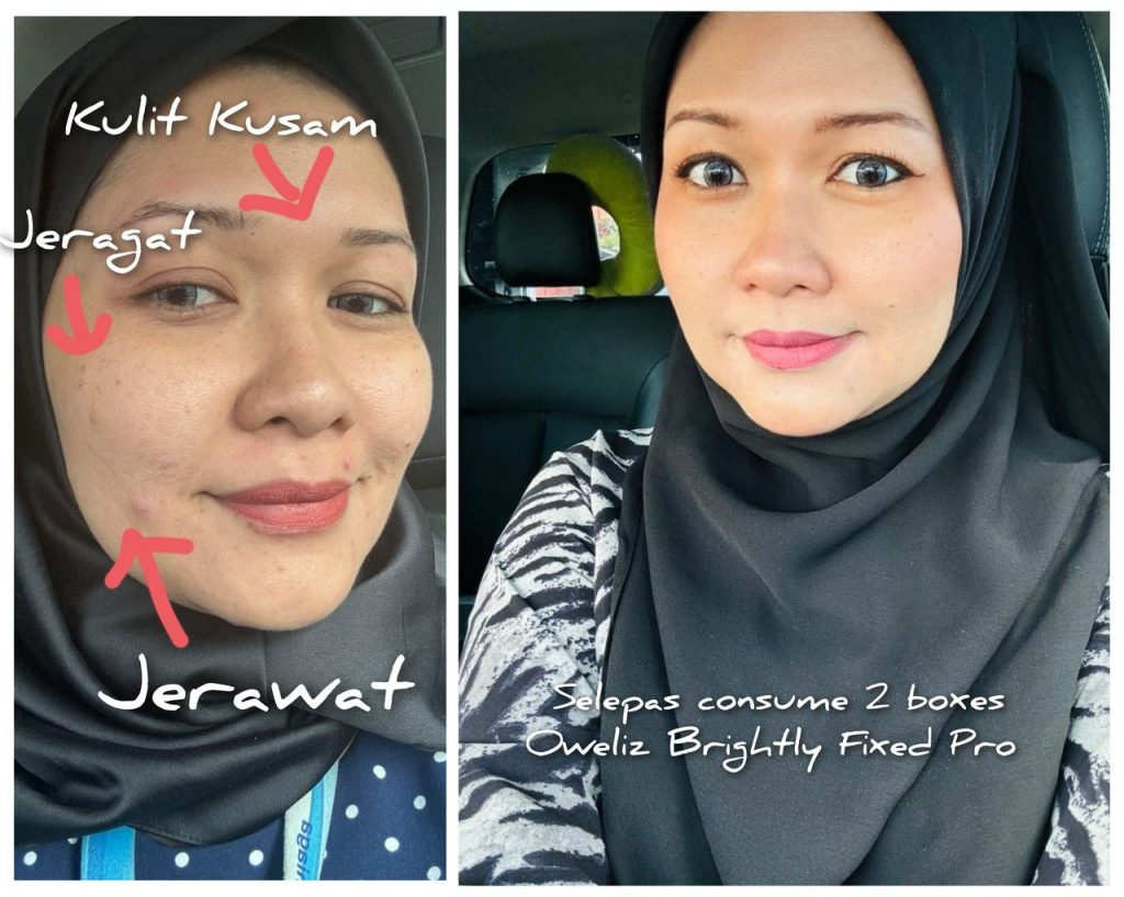 Oweliz testimoni
