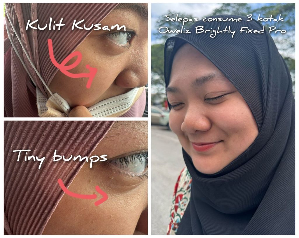 Oweliz testimoni
